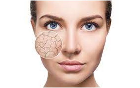 Nourishing Your Skin: The Importance of Shower Gel for Dry Skin